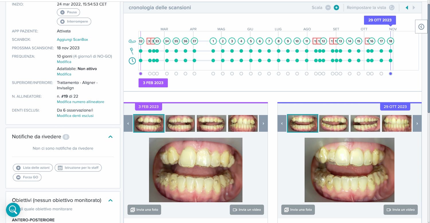 Monitoraggio da Remoto Programma Sorridi con Martina – Studio Dentistico Caneva Trieste