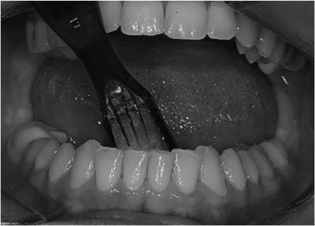 Studio Dentistico Caneva - Indicazioni sull'uso dello spazzolino